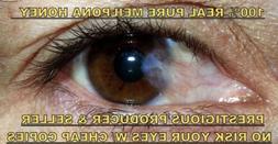 Red Pink Eye Cataracts Blurry Vision